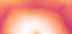 polyp darm